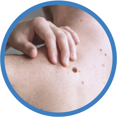 Itching, Bleeding, Tenderness